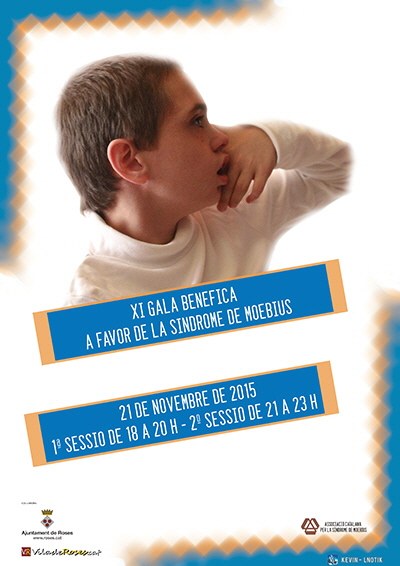 Festival Benèfic a càrrec de l'Associació Catalana per la Síndrome de Moebius